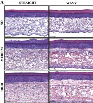 Entwicklung der Vollhautmodelle mit HES-Färbung nach unterschiedlicher Kulturzeit.