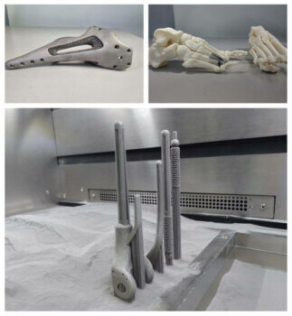Implantate hergestellt mit Eplus3D EP-M260 Metall-3D-Drucker bei Bioprotece 3D-gedruckte Implantate von Bioprotece, hergestellt mit der Eplus3D EP-M260 Metall-Additive-Fertigungsmaschine