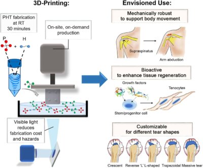 3D-druckbares bioaktives Material zur Reparatur von Schultersehnenverletzungen, entwickelt von der CUHK Illustration des 3D-druckbaren bioaktiven Materials der CUHK zur Reparatur von Schultersehnenverletzungen