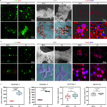 Chinesische Forscher nutzen zur Knochenerneuerung 3D-gedruckte Zinkstrukturen