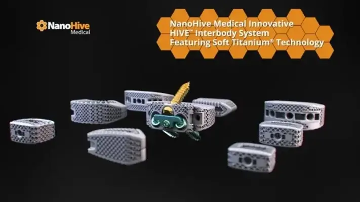 NanoHive Medicals innovative HIVE™-Zwischenkörpertechnologie mit Soft Titanium®-Technologie 3D-gedruckte Wirbelsäulenimplantate von NanoHive Medicals HIVE™-Zwischenkörpertechnologie mit Soft Titanium®-Technologie