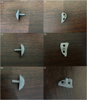 3D-gedruckte Titanimplantate in verschiedenen Größen zur Reparatur von Glenoiddefekten Verschiedene Ansichten von 3D-gedruckten Titanimplantaten zur Behandlung von Glenoiddefekten bei Schulterluxationen in 2 mm, 4 mm und 6 mm Breite