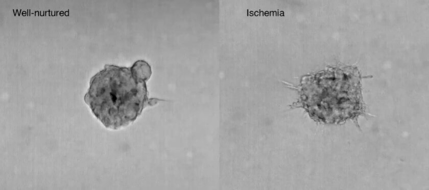 Unterschiede im Wachstum von Lungensphäroiden im 3MIC-Modell der New York University. Lungensphäroide im 3MIC-Modell, links in gut versorgten Bereichen, rechts in ischämischen Regionen.