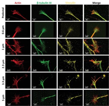 Neuronales Wachstum auf 3D-gedruckten Nanopillaren zur Erforschung von Hirngewebe Fluoreszenzmikroskopie von Neuronen auf 3D-gedruckten Nanostrukturen mit Markierungen für Aktin, β-Tubulin III und Vinculin