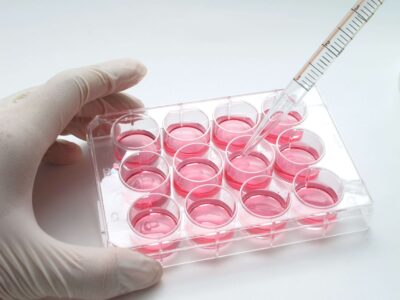 3D-Druck von Hydrogelen im biomedizinischen Labor zur Strukturierung von Mikrogewebe Pipettierung rosafarbener Zellkulturflüssigkeit in eine Mehrfach-Kulturplatte mit Hydrogelen zur Forschung im 3D-Druck von Geweben